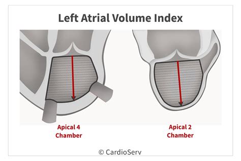 left atrium volume index calculator.